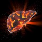 Reversing Liver Disease? Scientists Discover New Health Benefit of Semaglutide