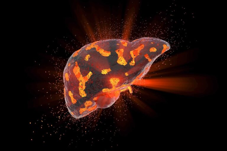 Reversing Liver Disease? Scientists Discover New Health Benefit of Semaglutide