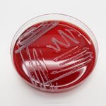 Growing Public Health Threat: New “Northern Lights” Bacteria Resists Multiple Antibiotics