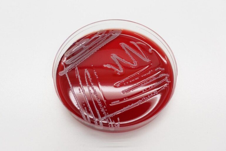 Growing Public Health Threat: New “Northern Lights” Bacteria Resists Multiple Antibiotics