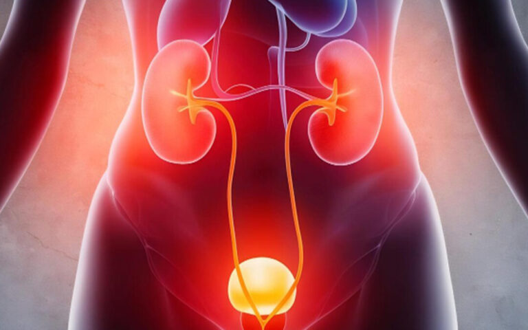 Urinary Tract Infections: Signs and symptoms plus management