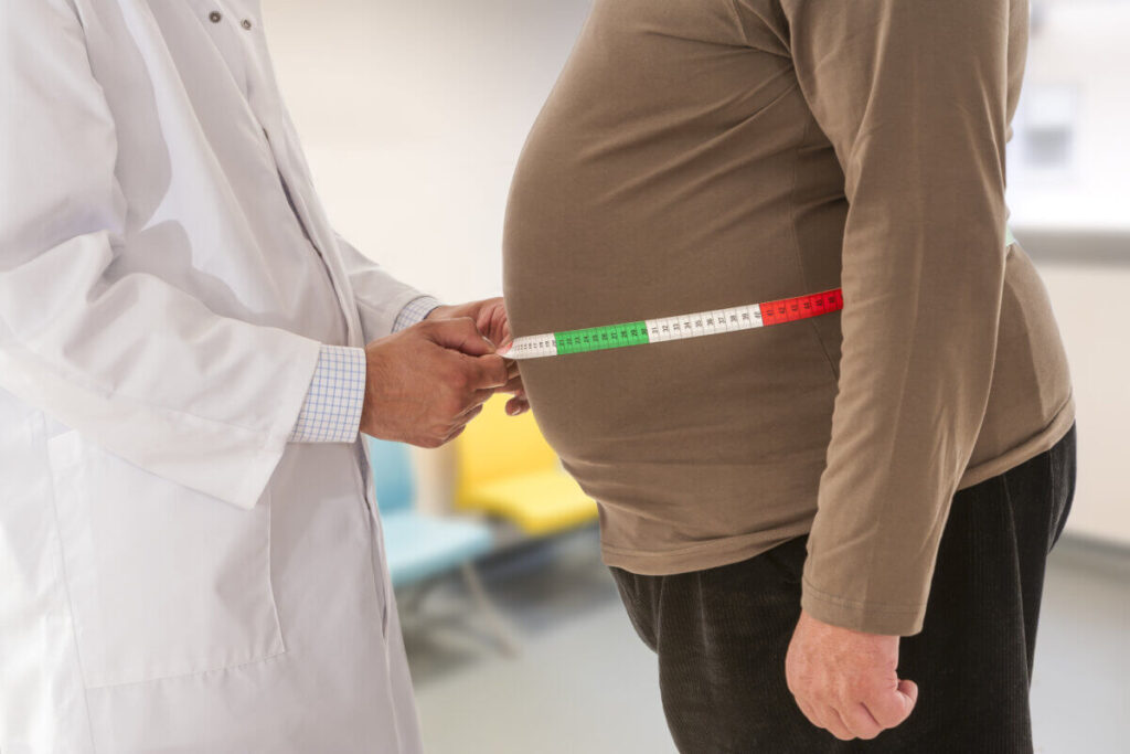 Obesity May Be Linked to More Cancer Cases Than Previously Estimated, Study Suggests