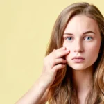 Perfect Skin, Real Damage: The Dangerous Beauty Trend Putting Teenagers Under Pressure